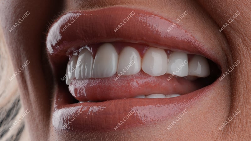 Smile symmetry